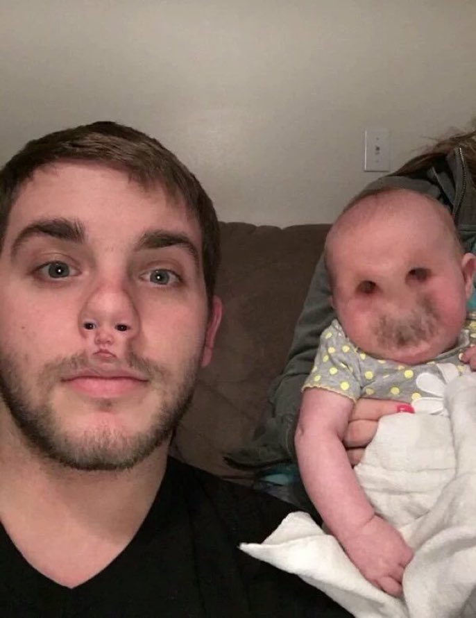 Face swap gone wrong!